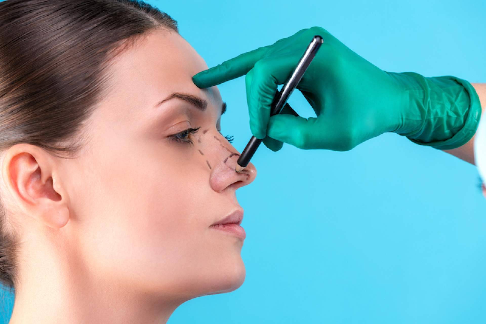 Rinoplastia ultrasónica en Clínica Dr. Millán Mateo
