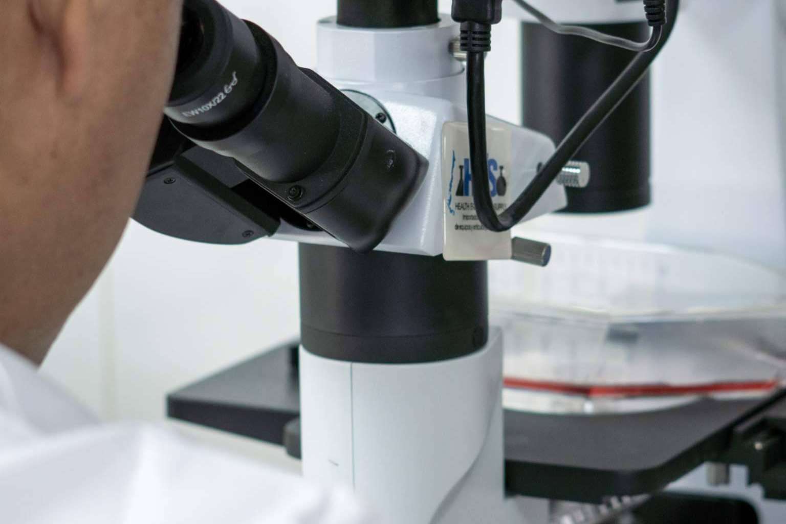 Oncovix; Inmunoterapia de Precisión, un Hito en la Revolución del Tratamiento del Cáncer