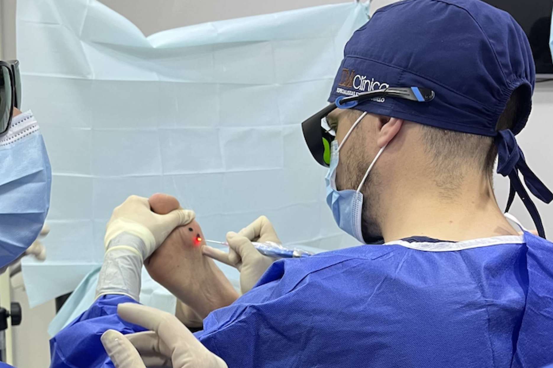 DM Clínica innova en podología con su tratamiento láser para cirugías de uñas y papilomas