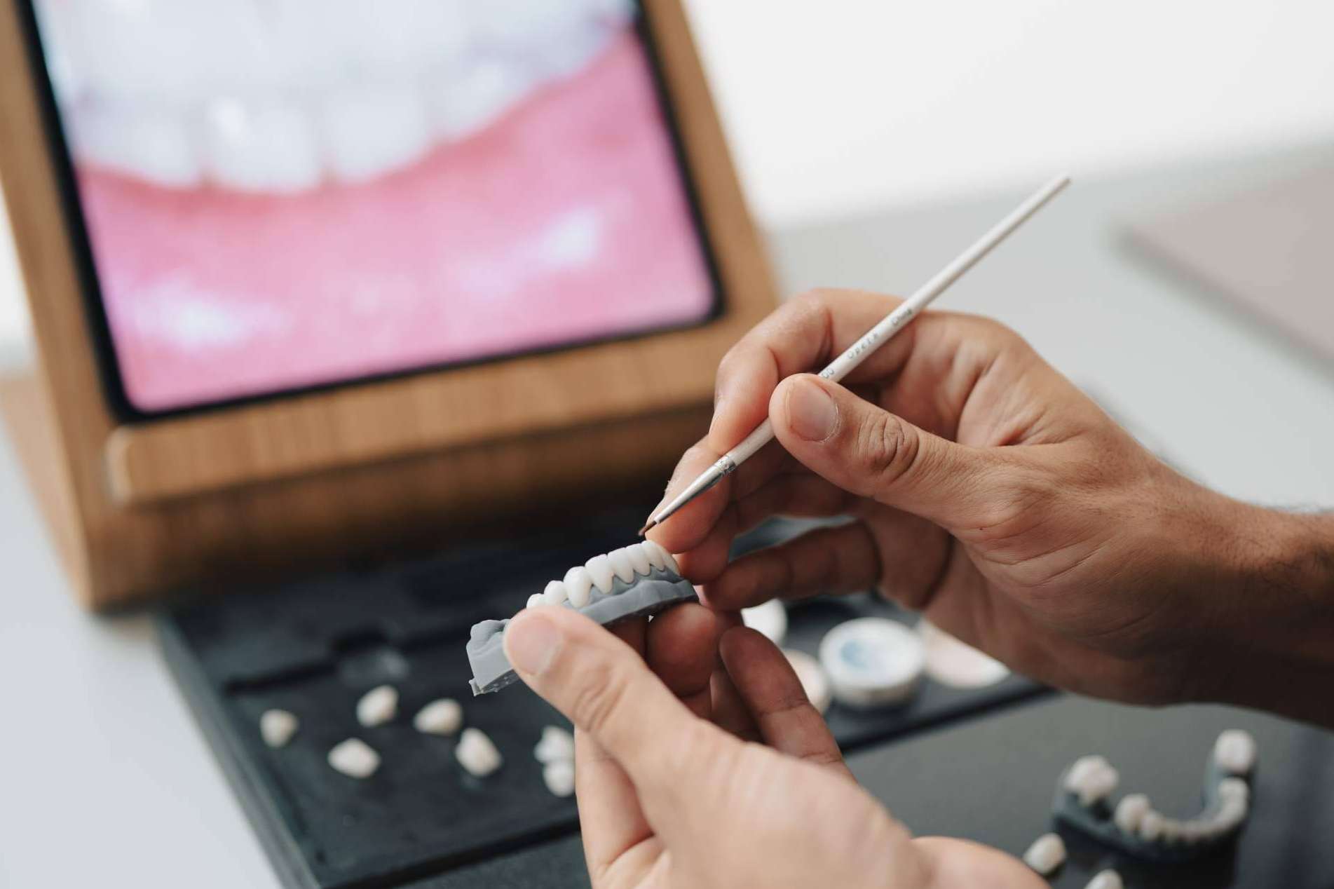 ACE DNTL STUDIO; Redefiniendo la Odontología en Marbella