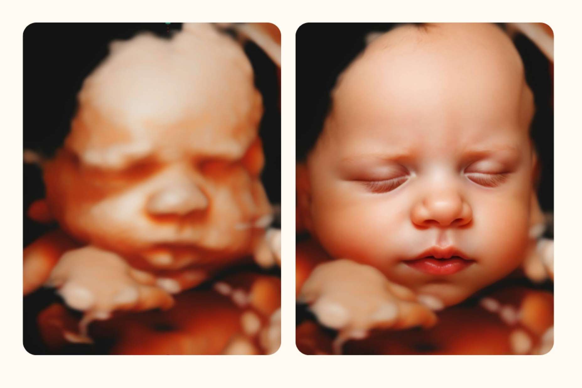 Ecox revoluciona la ecografía prenatal en colaboración con UltraEco 8K