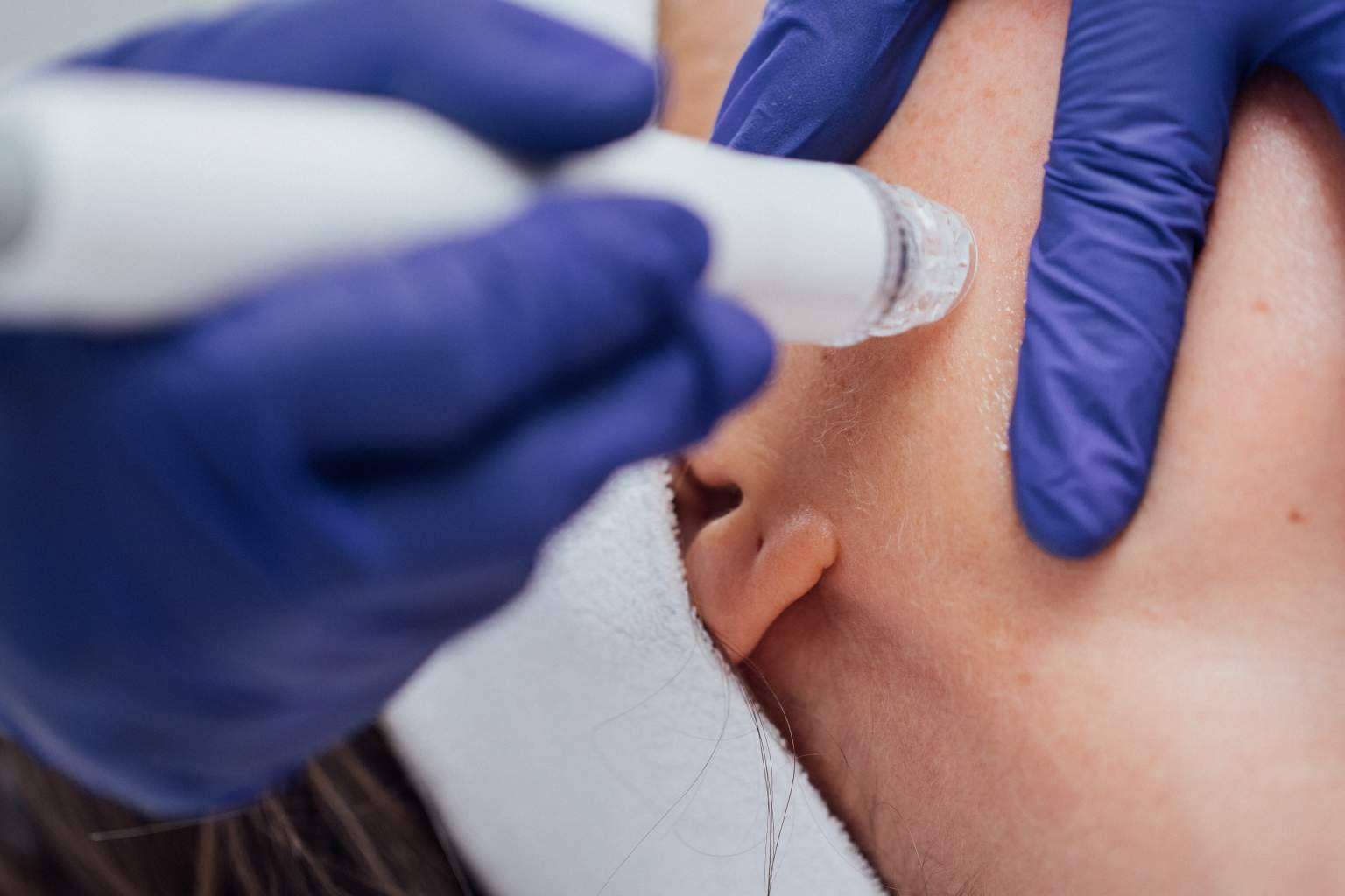 El tratamiento facial en Mallorca que cambiará la piel; Indiba Ona en Dermativa