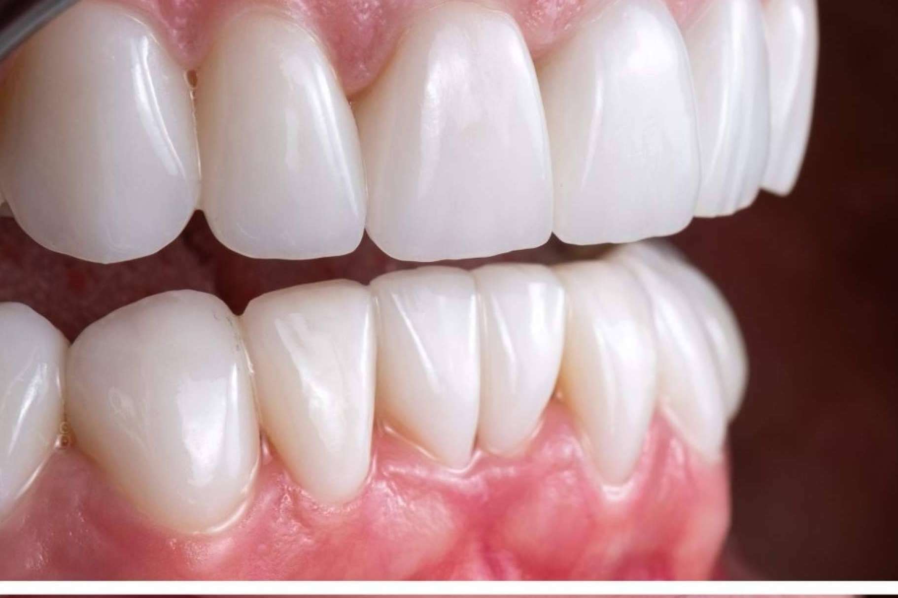 Cuidar la sonrisa a lo largo de los años