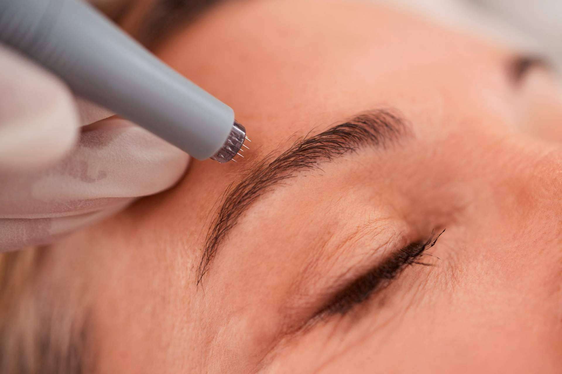 La revolución de la estética sin cirugía; tratamientos faciales y corporales que marcan tendencia