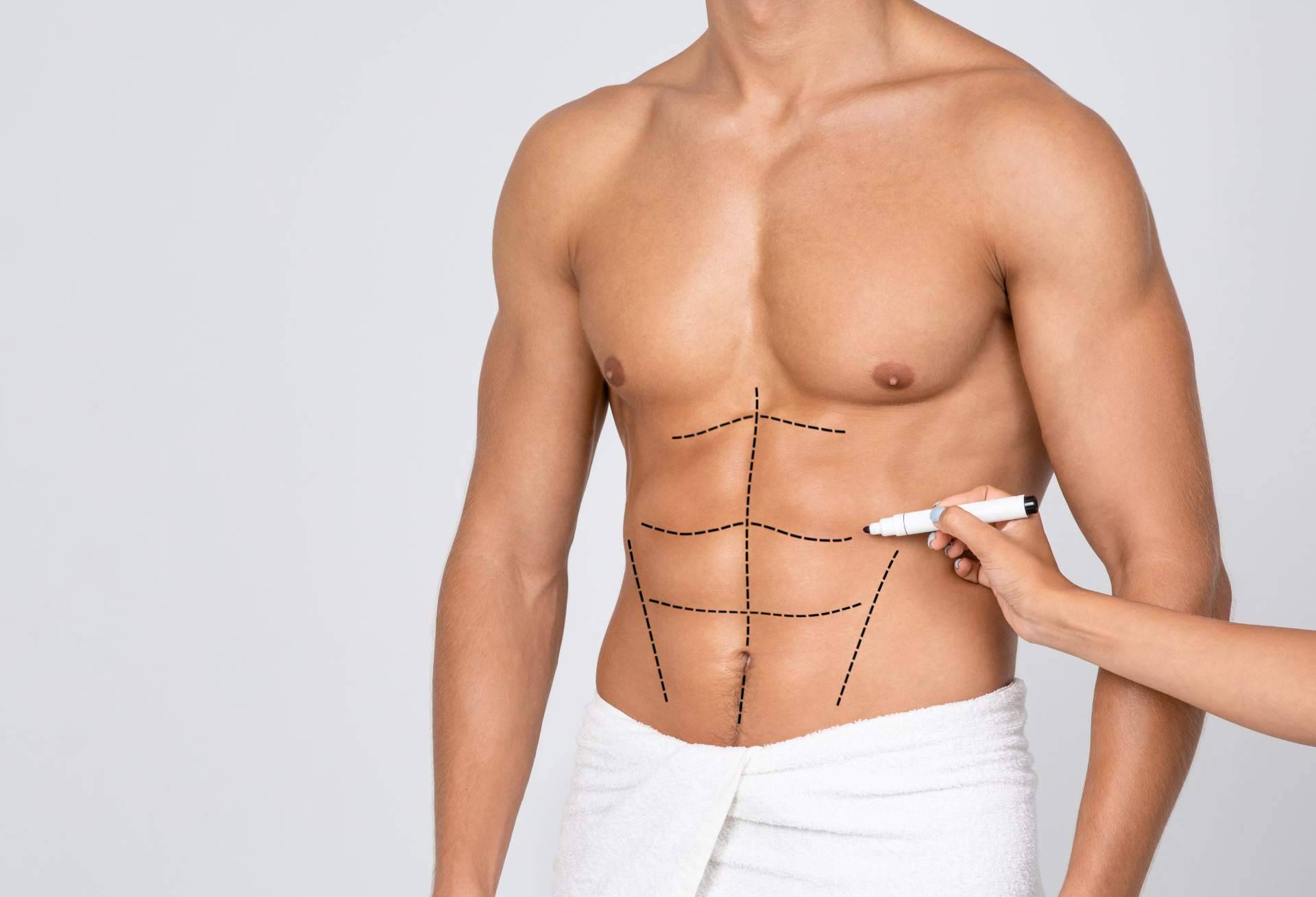 Cirugía Plástica Masculina; Desde remodelación corporal hasta rejuvenecimiento de la mirada