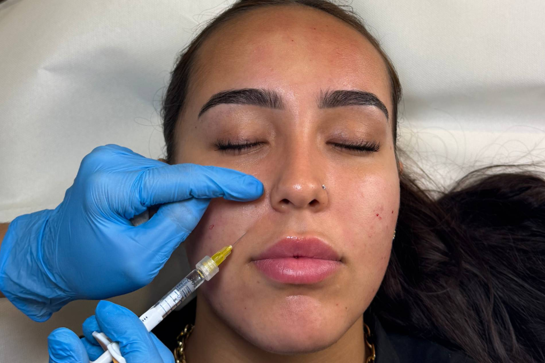 Skinbooster, hidratación profunda sin volumen para una piel más firme y luminosa